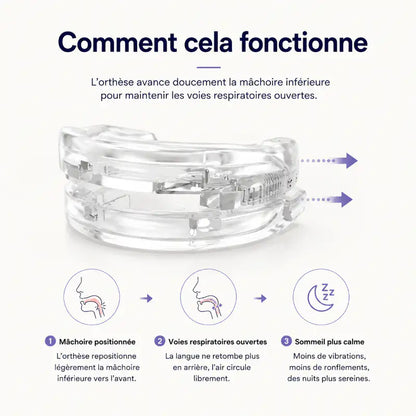 Schéma illustrant le fonctionnement d’une gouttière anti-ronflement qui avance légèrement la mâchoire inférieure afin de maintenir les voies respiratoires ouvertes pendant le sommeil.