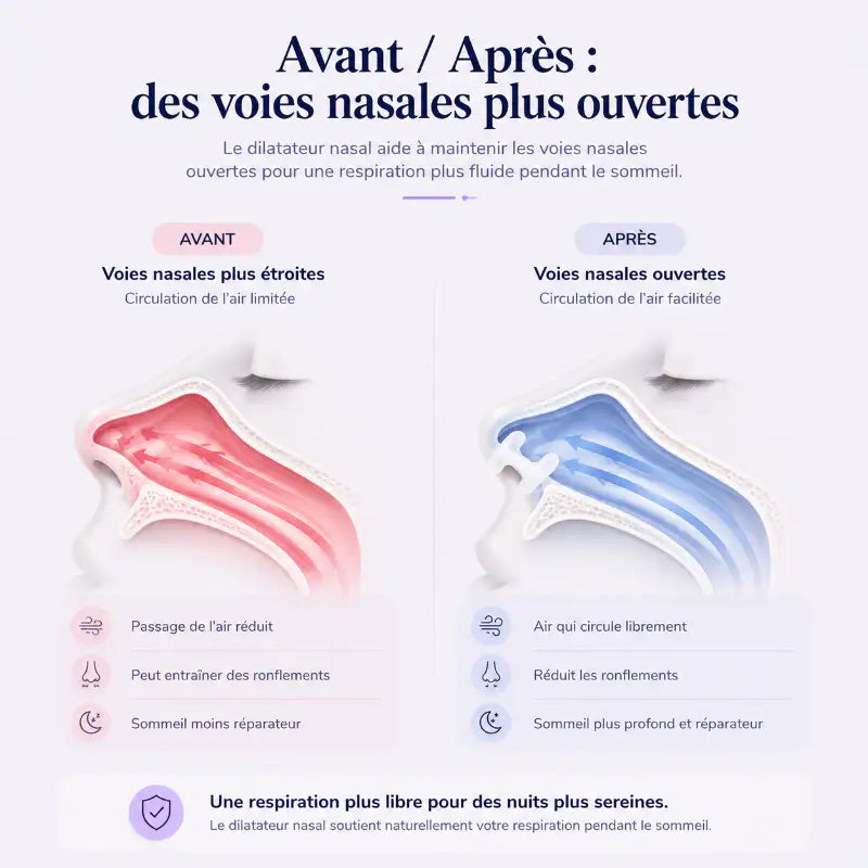 dilatateur-nasal-avant-apres-voies-nasales