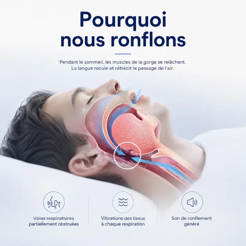 Schéma expliquant comment le relâchement des muscles de la gorge et le recul de la langue rétrécissent les voies respiratoires, provoquant des vibrations responsables du ronflement.
